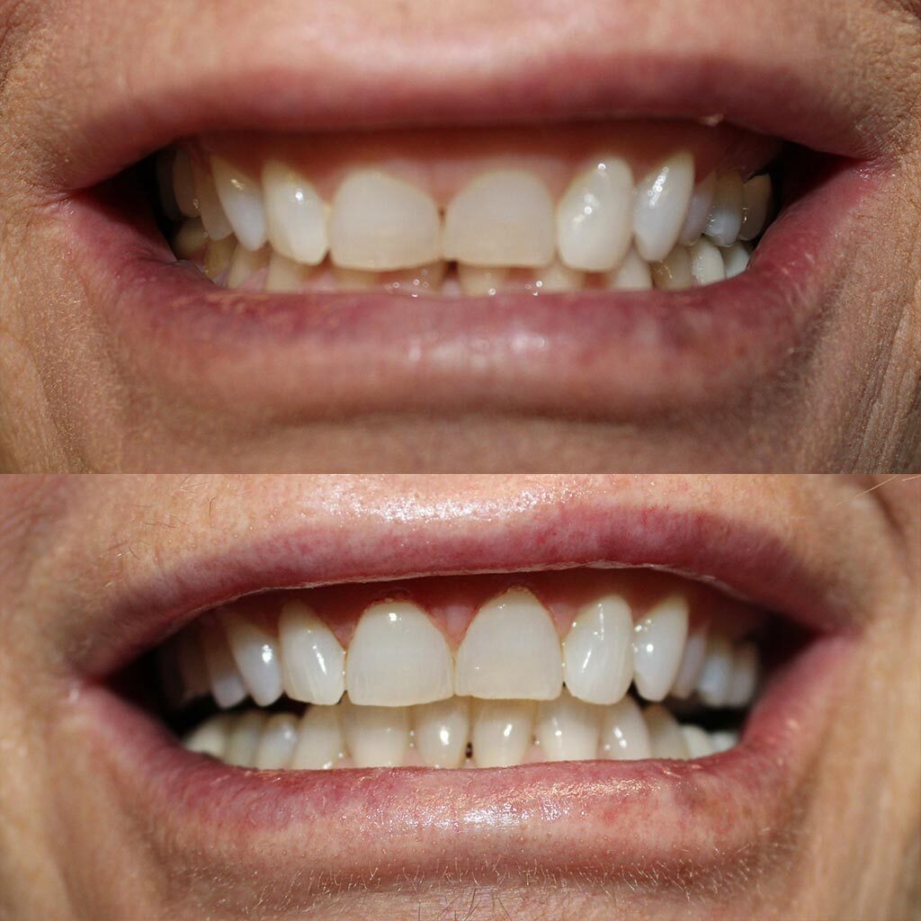 before and after update copy